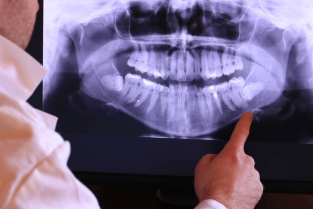 Best Dental Abscess Treatment in Lake Hopatcong, NJ