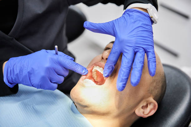 Best Broken or Chipped Tooth Repair in Lake Hopatcong, NJ