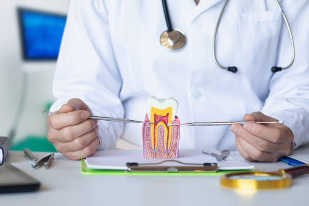 Best Knocked-Out Tooth (Avulsed Tooth) Treatment in Lake Hopatcong, NJ